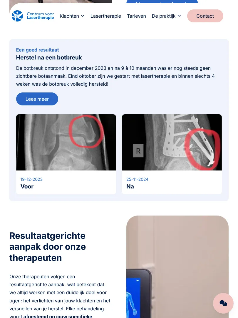 Centrum voor Lasertherapie resultaat